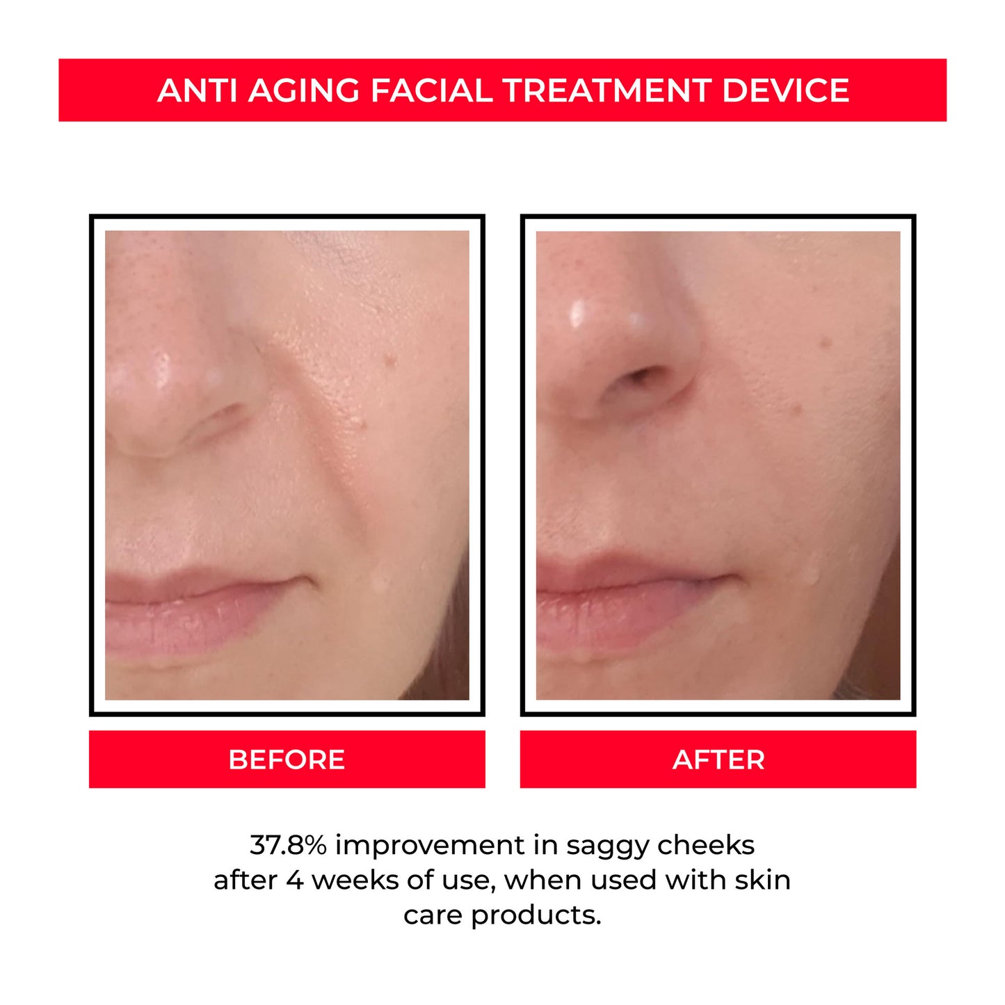 MicroLift Appareil Rajeunisseur facial Visage & Pores Microcourant