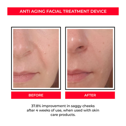 MicroLift Appareil Rajeunisseur facial Visage & Pores Microcourant
